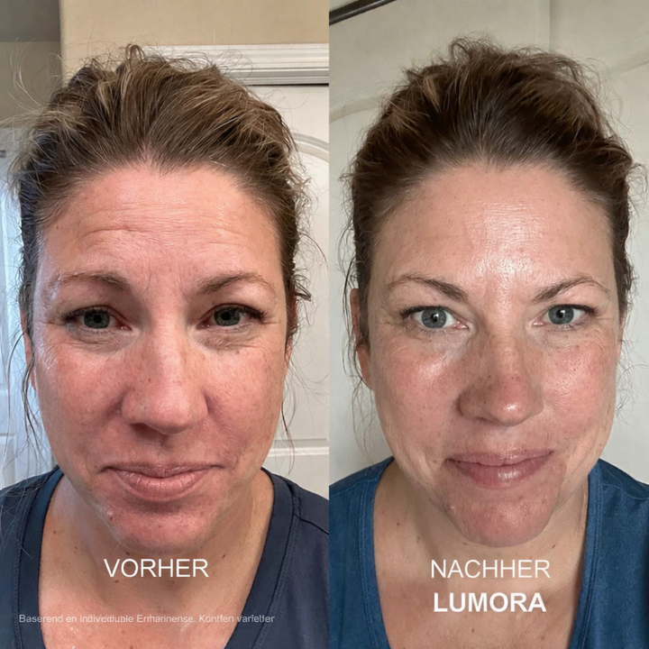 Lumora Micro Infusion System